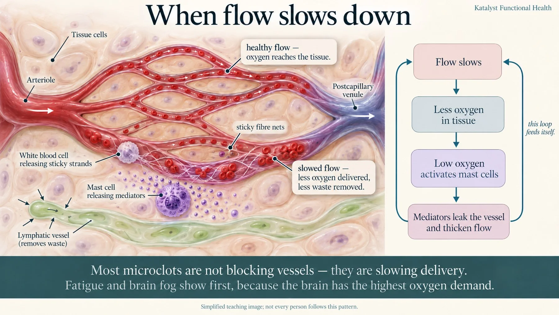 Capillary bed showing healthy flow above and slowed flow below, with a mast cell, a white blood cell releasing fiber nets, and a lymphatic vessel