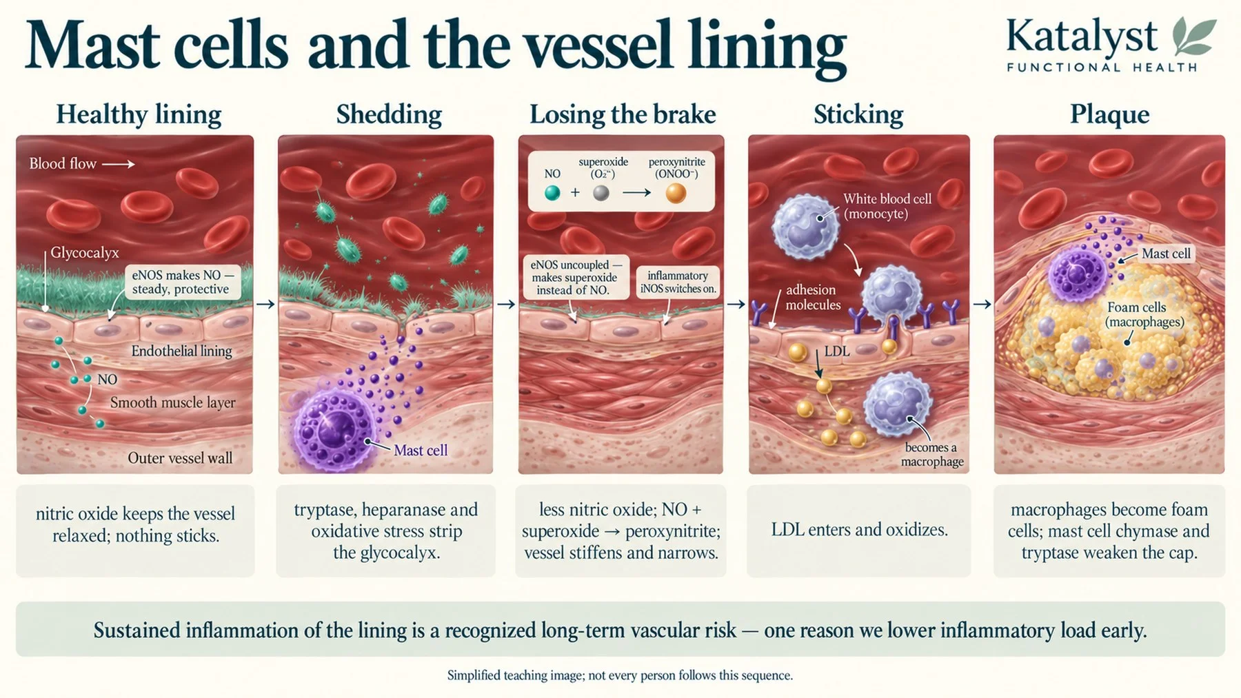 Five stages: healthy lining, shedding, losing the brake, sticking, plaque