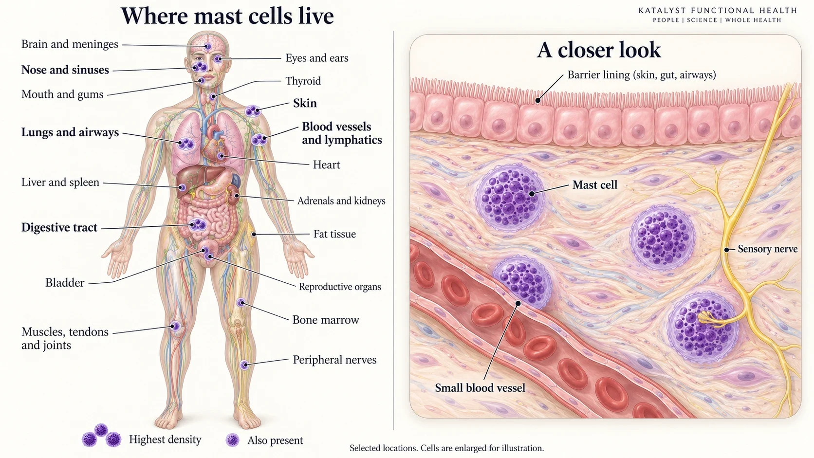 Where mast cells live: a body map of a standing adult with 18 labelled locations. Clusters of mast cells mark the highest-density sites: skin, nose and sinuses, lungs and airways, digestive tract, and blood vessels and lymphatics. Single mast cells mark sites where they are also present: brain and meninges, eyes and ears, mouth and gums, thyroid, heart, liver and spleen, adrenals and kidneys, fat tissue, bladder, reproductive organs, muscles, tendons and joints, bone marrow, and peripheral nerves. A close-up shows mast cells in the tissue under a barrier lining, one touching the wall of a small blood vessel and one with a sensory nerve ending wrapped around it.